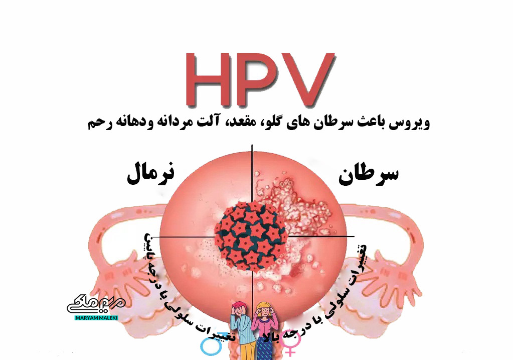 ویروس-HPV