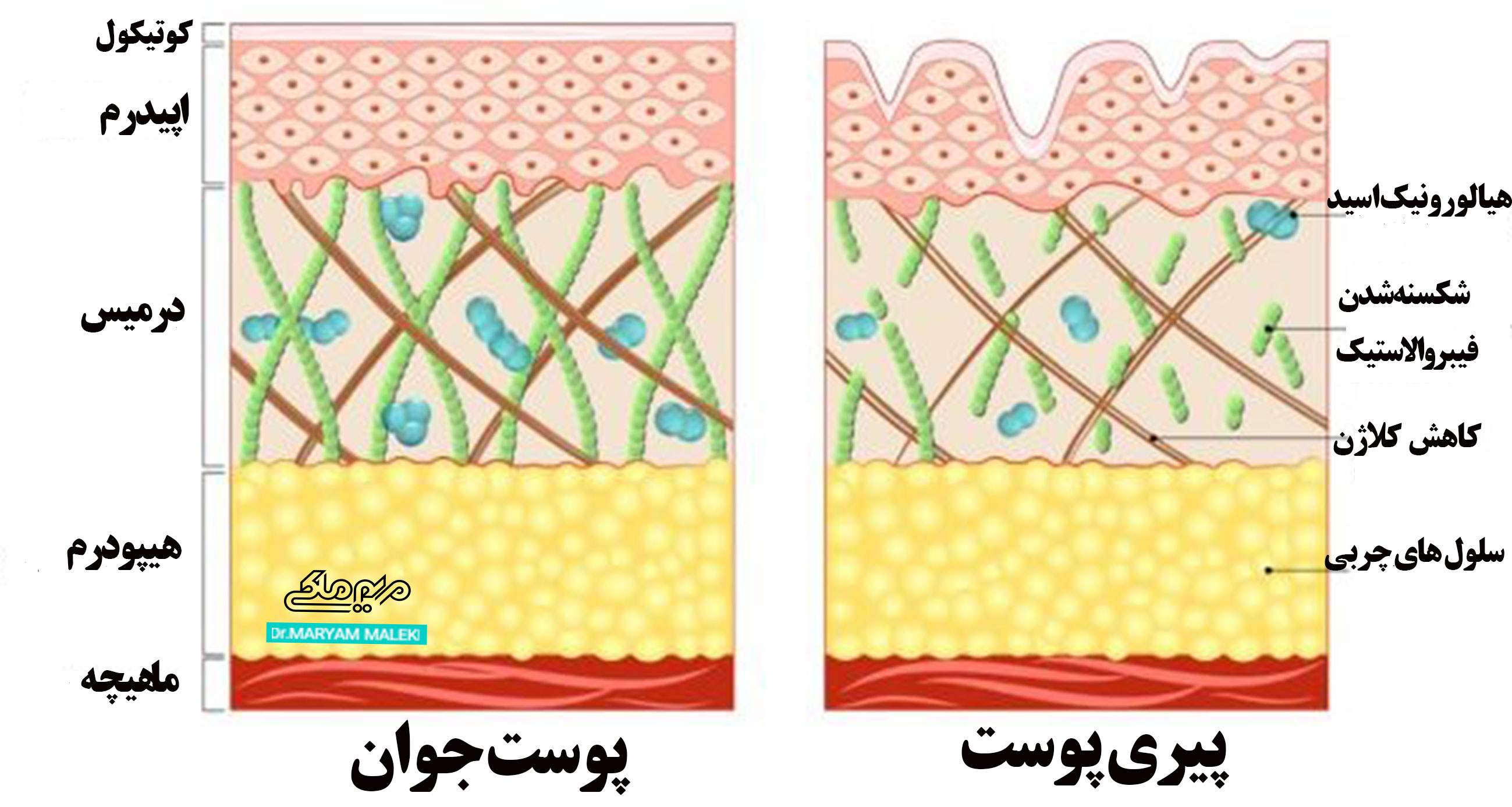 پیری-پوست-و-تاثیرات-ان