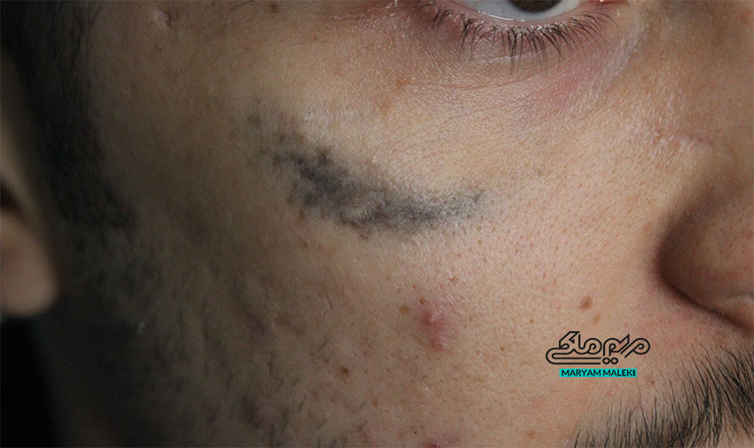 -فرکشنال-کیوسوئیچ-ال-ای-دی