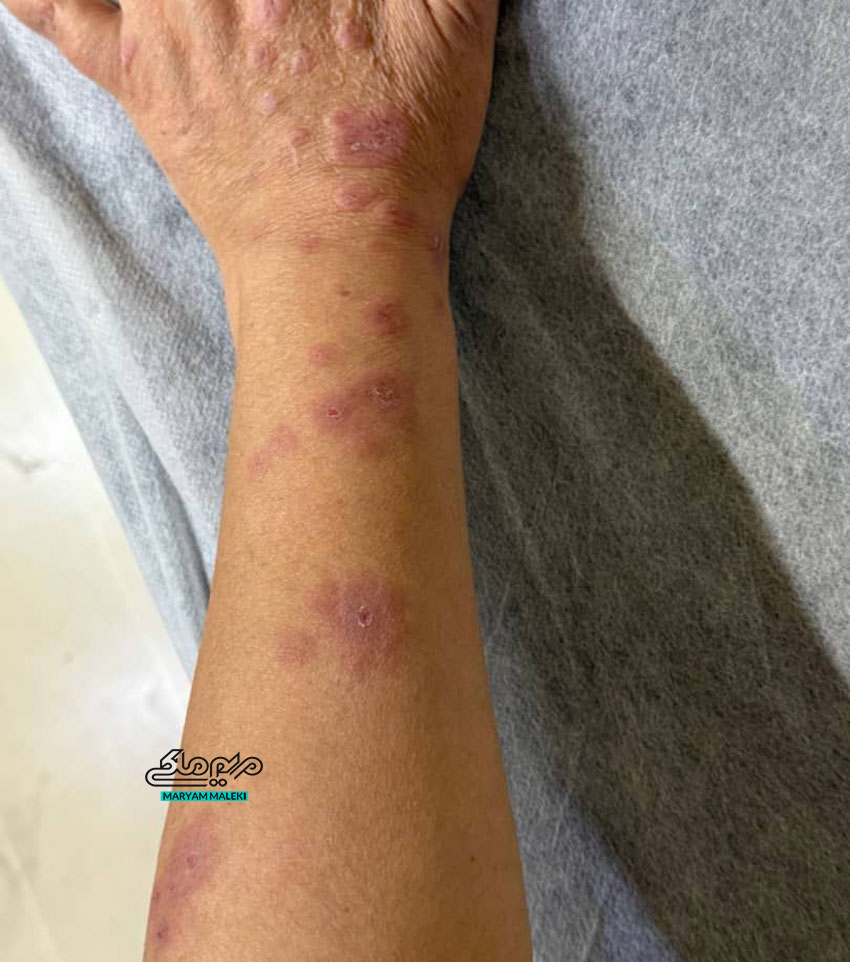 اریتم-مولتی-فرم2