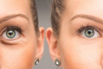 روش‌‌های مختلف جوانسازی پوست دور چشم