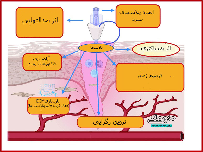 cold plasma operaton
