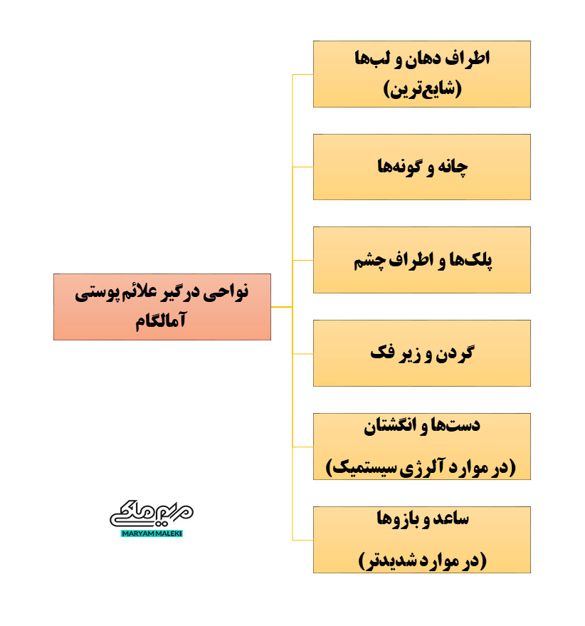 نواحی-درگیر-علائم-پوستی-آمالگام
