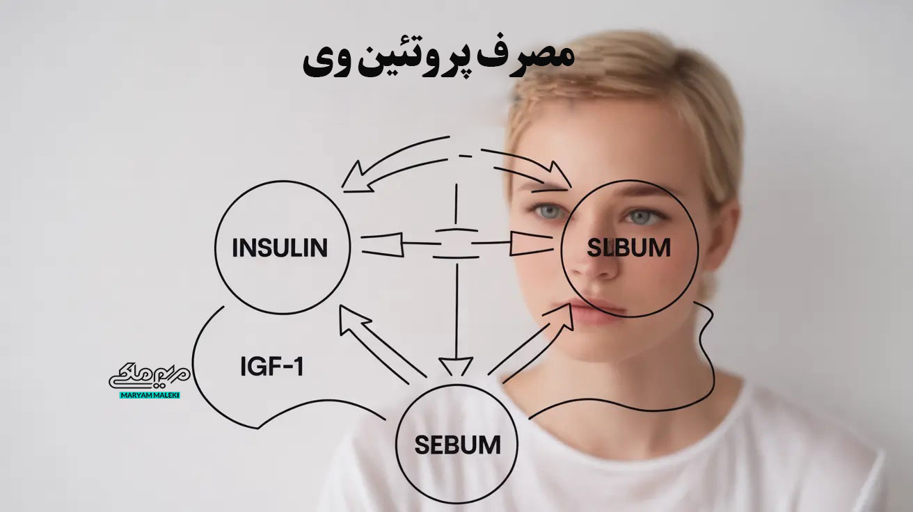 whey-protein-acne-hormonal-