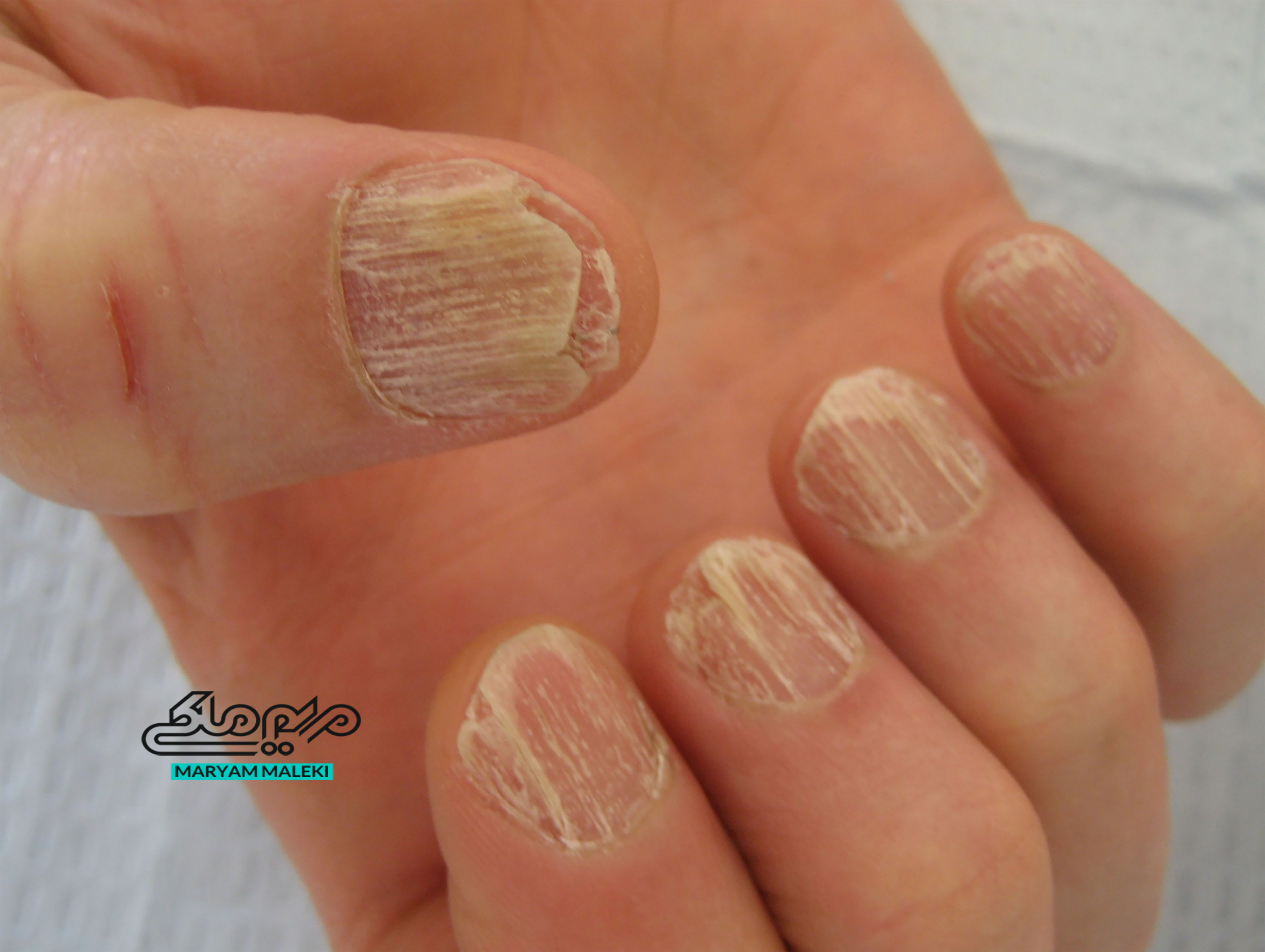 ناخن های سنباده ای